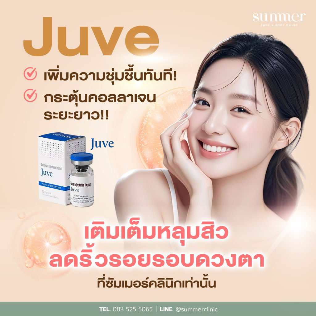 juvelook