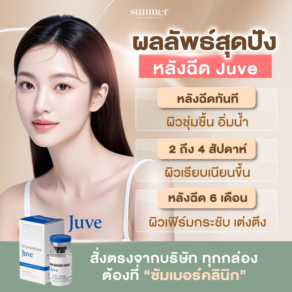 juvelook